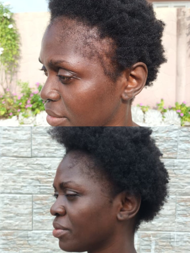 Élixir Capillaire 3-en-1 • Croissance, Force & Nutrition Intense