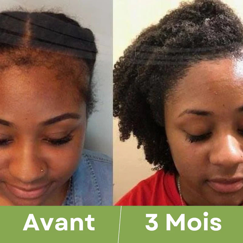 Élixir Capillaire 3-en-1 ( 01 acheté = 01 offert ) • Croissance, Force & Nutrition Intense.