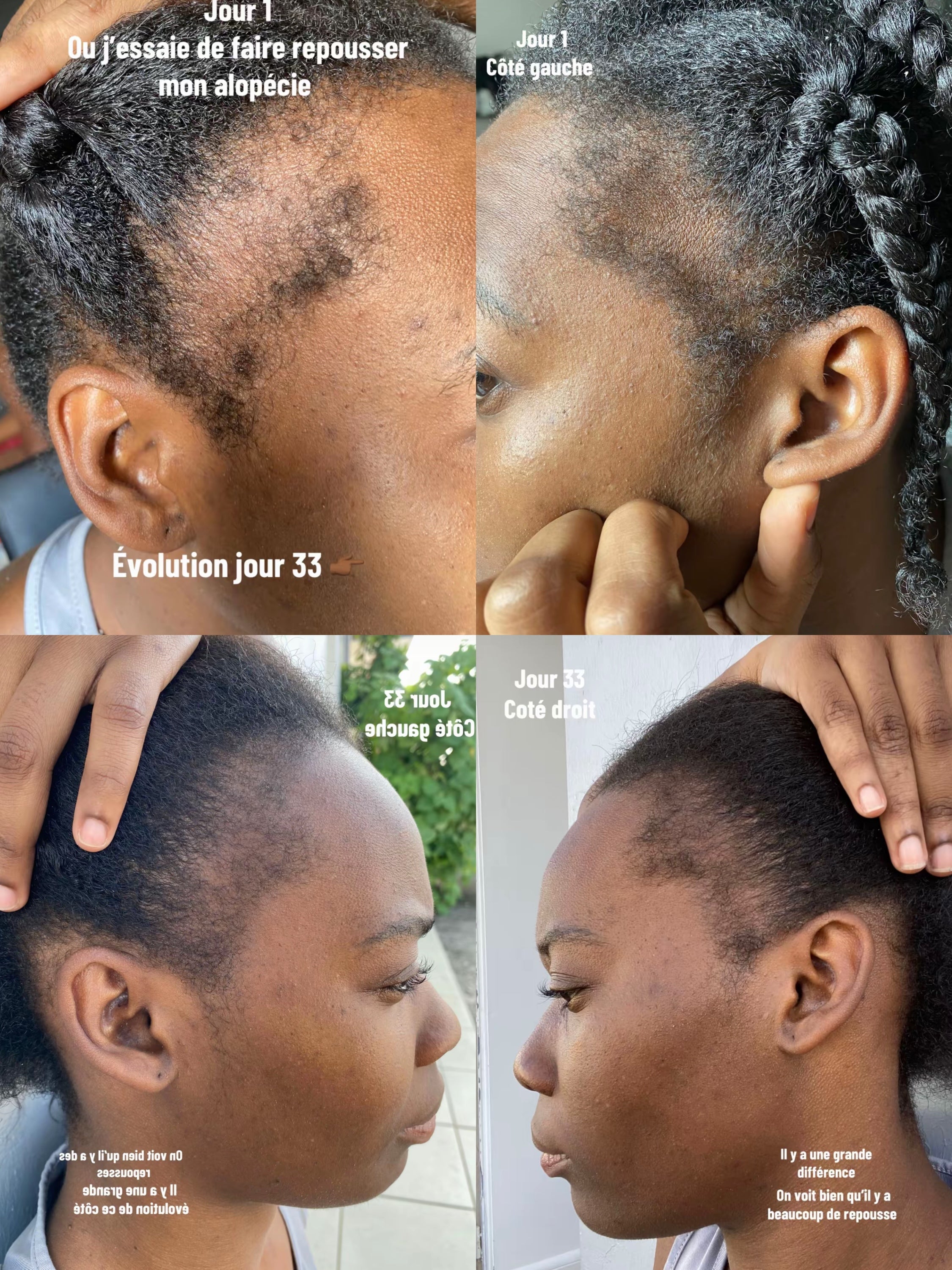 Élixir Capillaire 3-en-1 ( 01 acheté = 01 offert ) • Croissance, Force & Nutrition Intense.