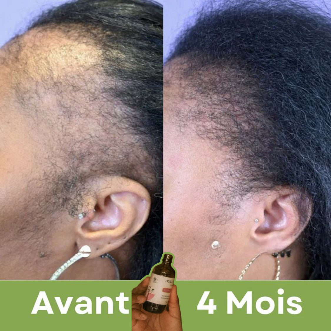 Élixir Capillaire 3-en-1 ( 01 acheté = 01 offert ) • Croissance, Force & Nutrition Intense.